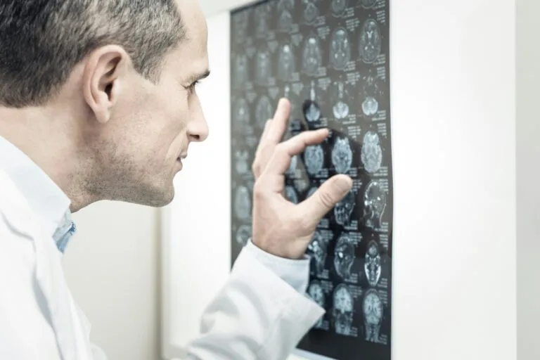 doctor looking at brain scan imaging